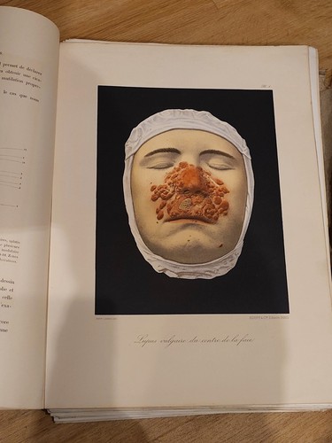 Rare musée l hôpital - rare,, l'hôpital
