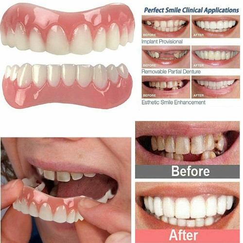 Dentier cosmétique fausses - dentier,