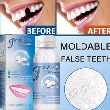 Dentier provisoire fausses