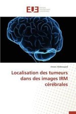 Localisation des tumeurs dans