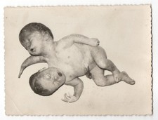 1950 Siamese Baby Medical Photo - Figuig Hospital Morocco