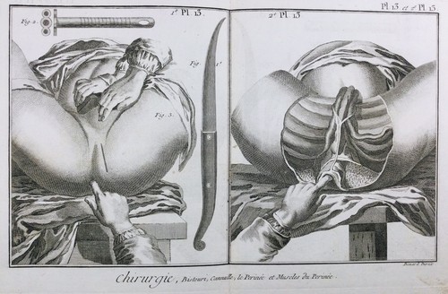 Gynécologue 1779 chirurgie - en,