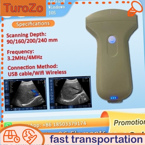 Wireless ultrasonic convex