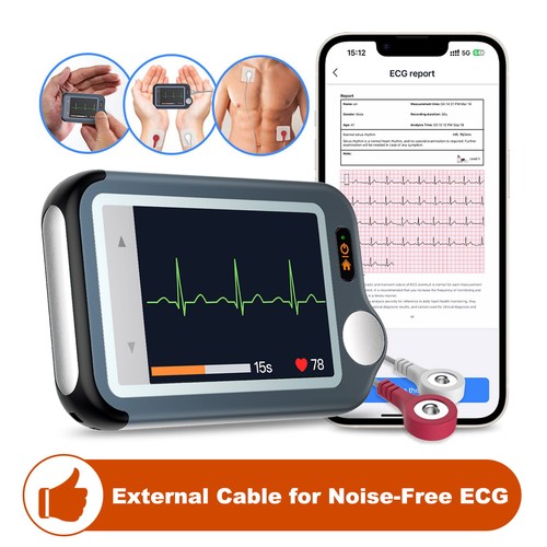 Checkme bluetooth ekg - bluetooth,