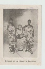 Woman of Africa Albinos. Curiosity and Human Phenomenon.  Old postcard 7149