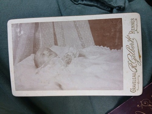 Post mortem baby his - on,