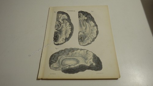 1850 lithographie couleur - 1850.lithographie,