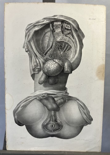 Lithographie dissection de - lithographie, :