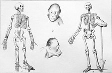 SQUELETTE de CHIMPANZÉ & SQUELETTE HUMAIN + TÊTE d'ORANG-OUTAN ROUX- Gravure 19e