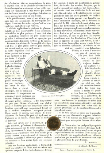 Sudation par tricots - sudation,