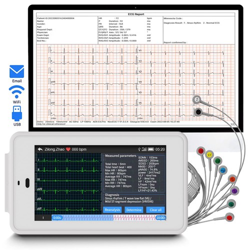 Lead portable ecg machine - portable,