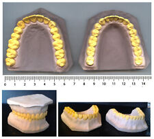 (dental prosthesis) - plaster casting JAWS top and bottom - 70's