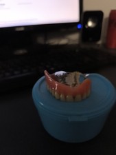 Denture denture top with palace cabinet curiosity dental art 