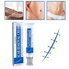 30g SCAR REMOVAL CREAM Skin
