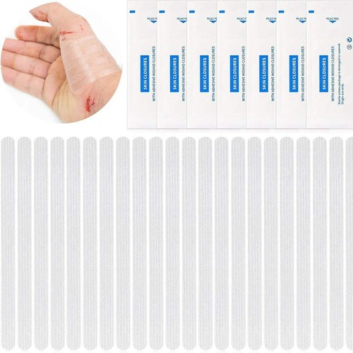 Wound skin closure strips - wound,