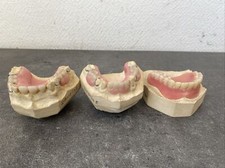 3 Anciennes Prothèses Dentaires Provisoire Support Fausse Dent Curiosité 