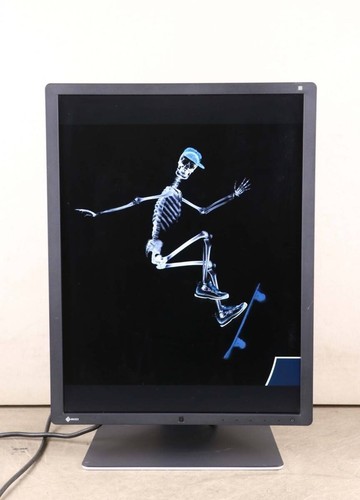 Moniteur médical eizo - moniteur,