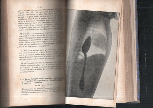 Livre rare journal medecine - livre,