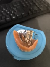 Denture denture high with palace cabinet curiosity strange dental art