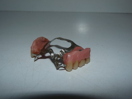 Ancien dentier prothèse
