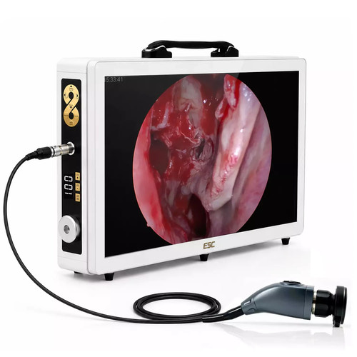 Portable 1 endoscopy - 3-in-1,