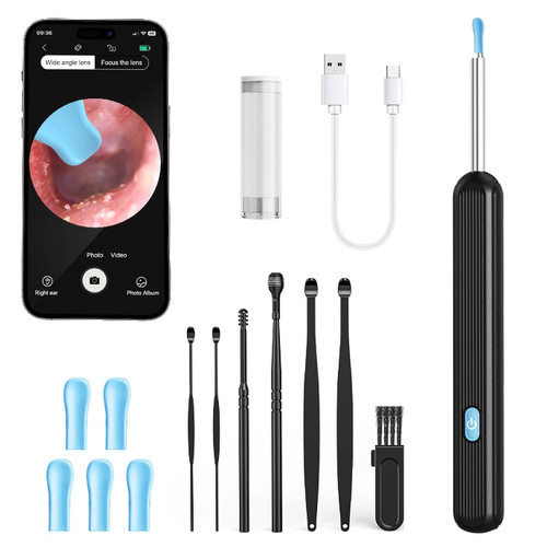 Otoscope oreille 1080p - otoscope,