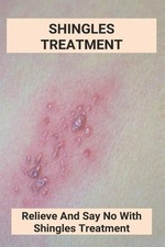 Columbus Tomasic Shingles