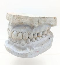 Vintage Dental Plaster Cast