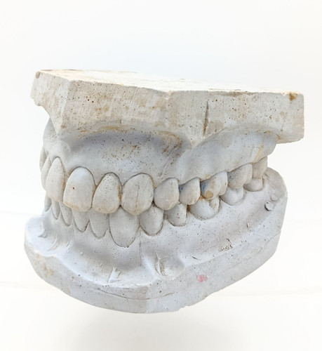 Vintage dental plaster cast - plaster,