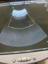 GE RAB 4-8 L voluson 730 transducer