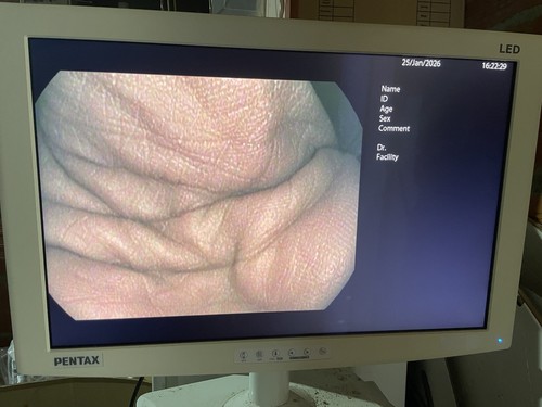 Moniteur écran radiance - Écran,