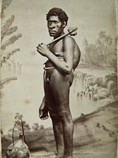 CDV photo Allan Hughan Noumea - Pacific native, crippled hunchback, headache