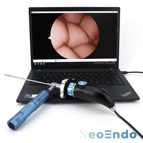 Portable medical usb - portable, endoscope