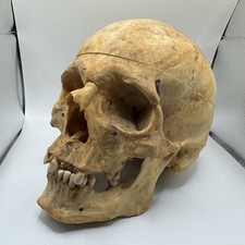 Crâne Humain ancien -