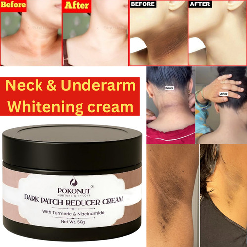 Crème anti écussons foncés - crème,