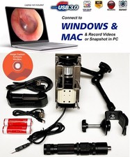 Rigid Endoscope Endoscopy Hospital HD USB Camera+Coupler+LED Light Source+Mount