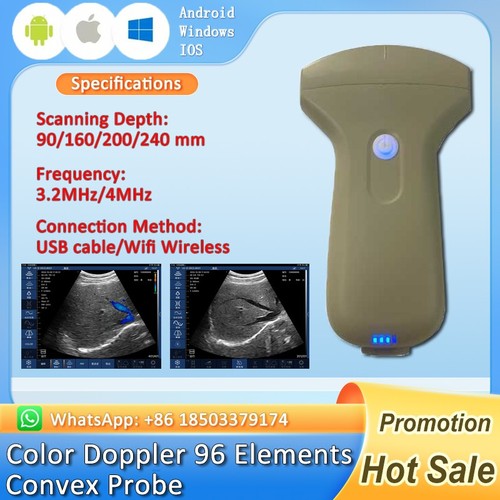 Wireless ultrasonic convex