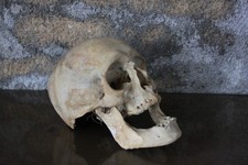 Ancien Crâne Humain,Anatomie