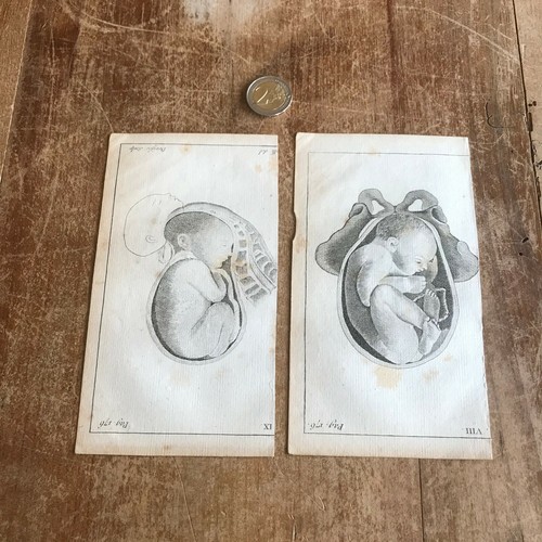Ancienne gravure anatomie n109 - ancienne,