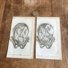 ancienne gravure anatomie N98