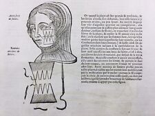Chirurgie Esthétique Chirurgie du Visage 1585 Docteur Houllier Gravure Médecine