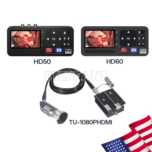 1080p full endoscopy - full, hd