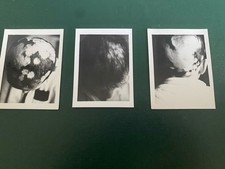Triptych Of Photos Of A Human Skull Circa 1950 Evokes Francis Bacon Or Others »