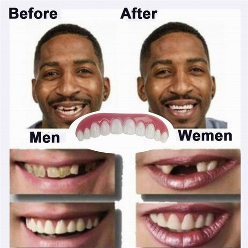 Dentier silicone pour - en,