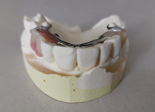 Dentier moulage plâtre partie - dentier,