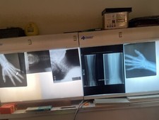 SCRAP X-RAY FILM - 1LB (Silver